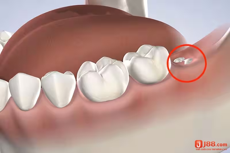 Nằm mơ thấy người yêu mọc răng cho thấy mối quan hệ tình cảm của bạn đang gặp vấn đề