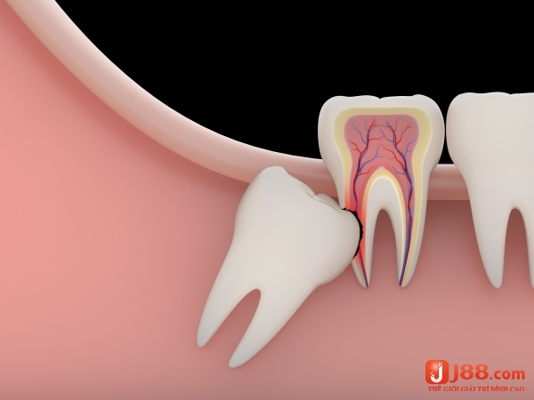 Mơ thấy mọc răng mang lại nhiều tín hiệu cho anh em