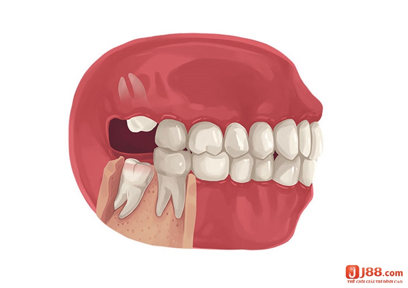 Mơ thấy mọc răng đánh đề con gì còn phải đợi chuyên gia lí giải