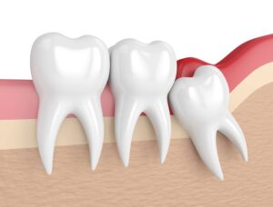 Mơ thấy mình mọc răng đánh đề con gì tài lộc đến?